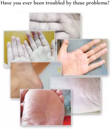 Footy Cream™ - Herstelcrème voor droge en schrale plekjes