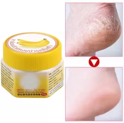 Footy Cream™ - Herstelcrème voor droge en schrale plekjes