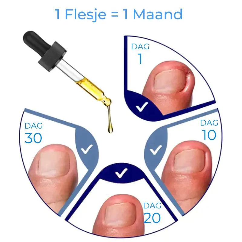 JoyPretty™ | Krijg prachtige nagels in slechts 7 dagen! | 1+1 Gratis