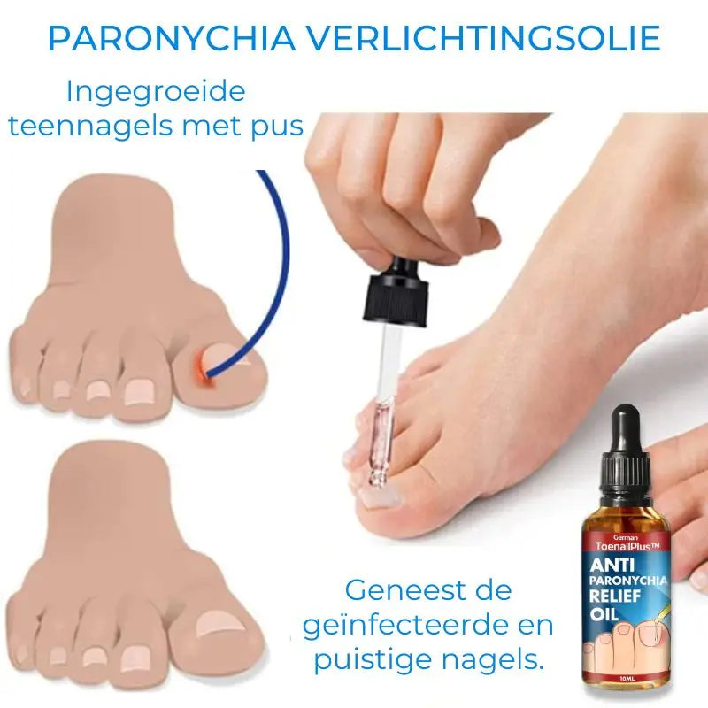 JoyPretty™ | Krijg prachtige nagels in slechts 7 dagen! | 1+1 Gratis