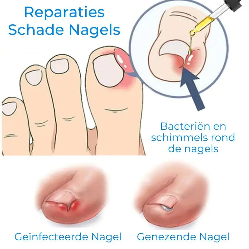 JoyPretty™ | Krijg prachtige nagels in slechts 7 dagen! | 1+1 Gratis