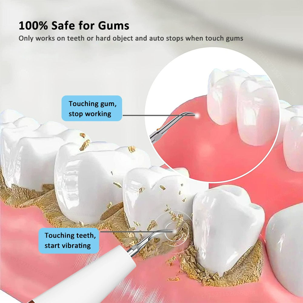 SonicSmile | Houd je gebid altijd schoon bespaar tandarts kosten