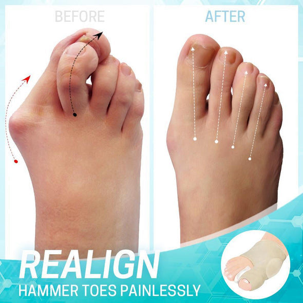 Dr.Huta | Bunion Correction Sleeve | 1+1 Gratis (2 paar)