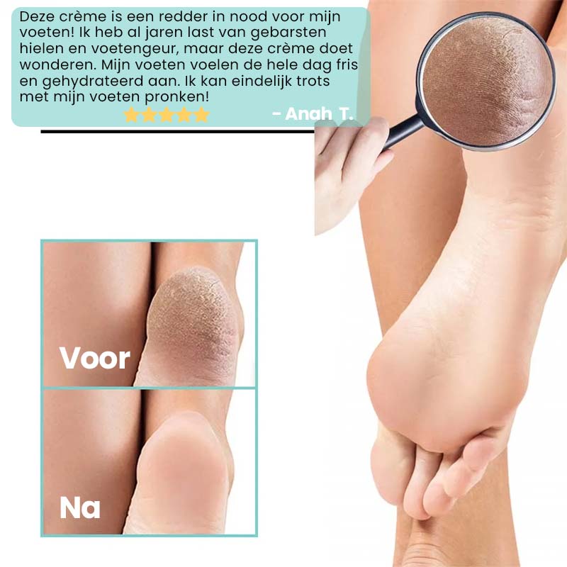 PediRejuven™ | Voetreparatiecrème