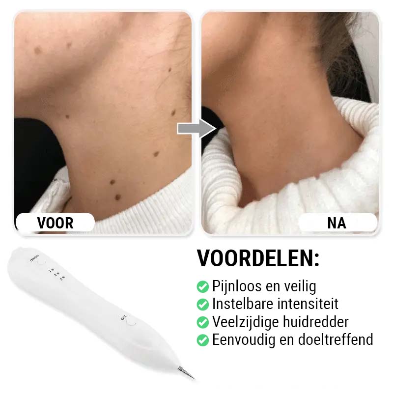 FlawlessFix™ Elektrische Schoonheidspen