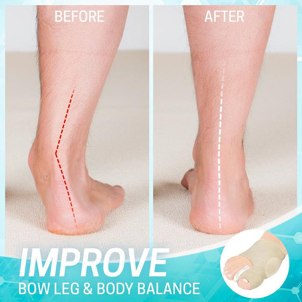 Dr.Huta | Bunion Correction Sleeve | 1+1 Gratis (2 paar)