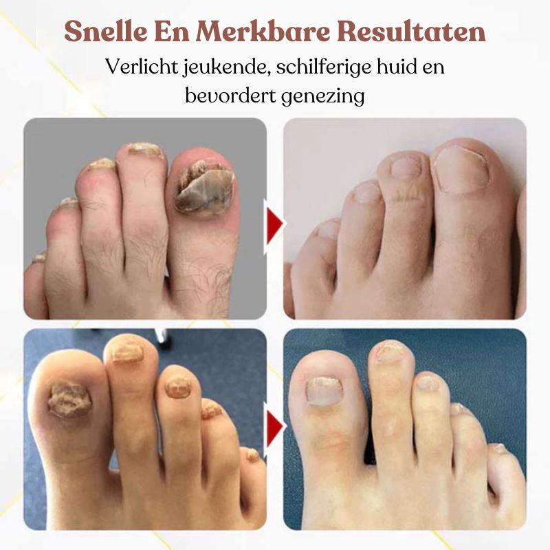 ToeTonic™ Nagel Herstel Serum