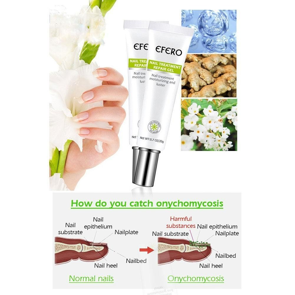 NailFix™ Snel en effectief resultaat!