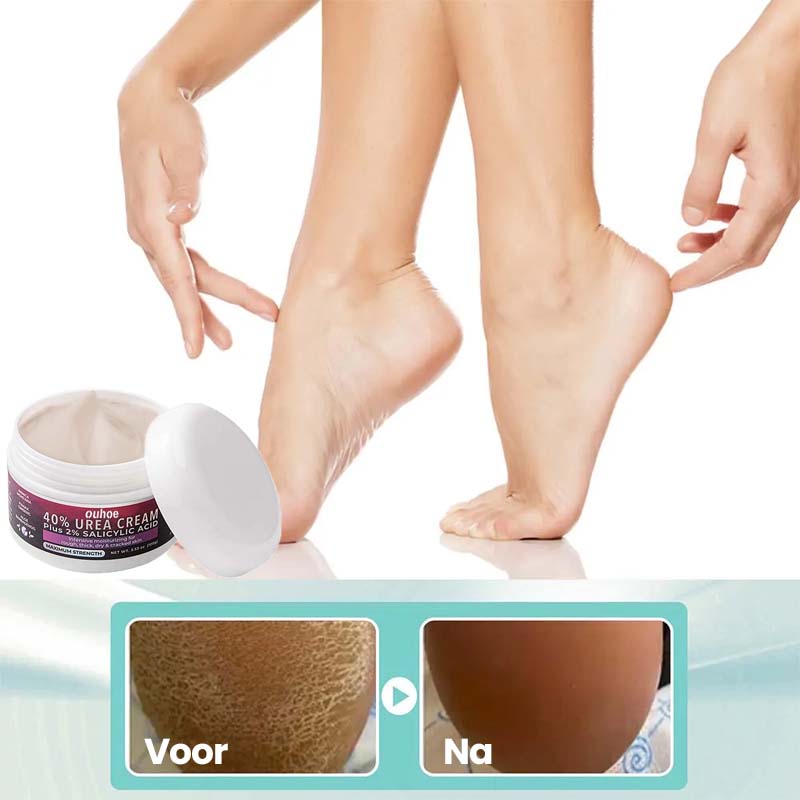 PediRejuven™ | Voetreparatiecrème