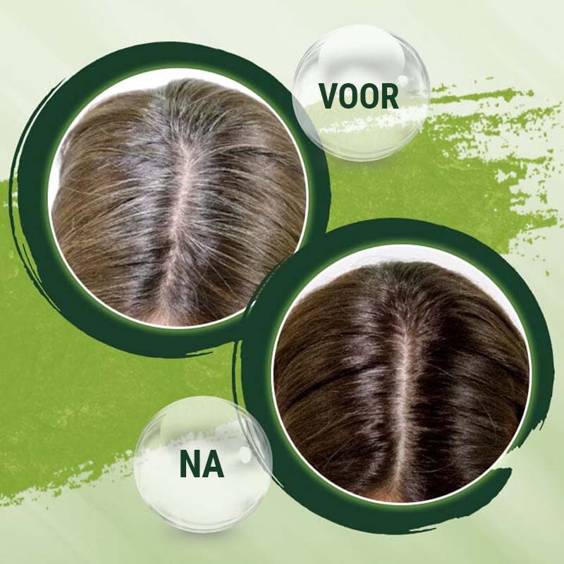 HairRevive™ Resultaat in 2 dagen!