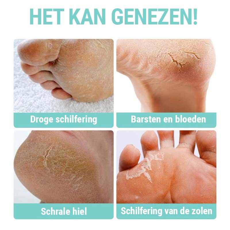 PediRejuven™ | Voetreparatiecrème