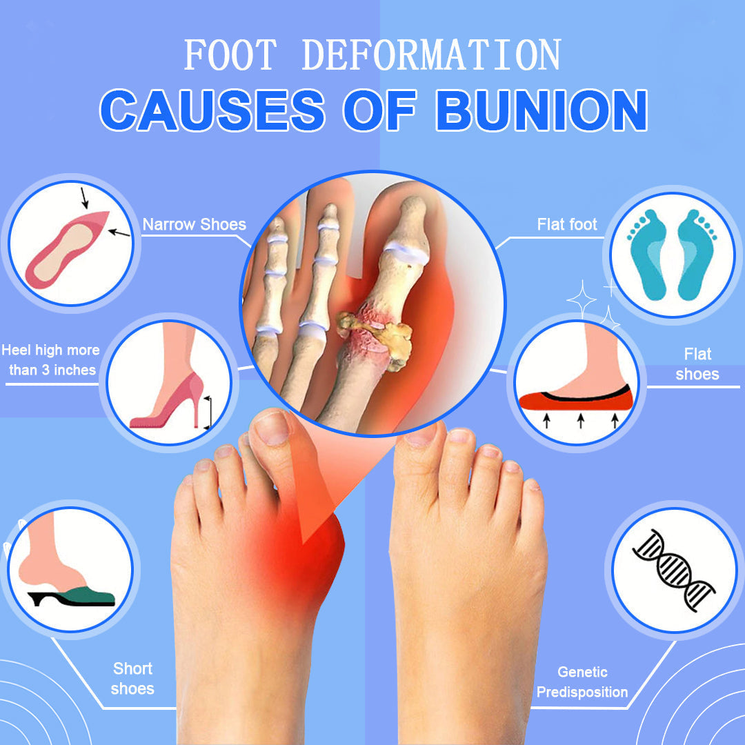 BunionBuster™ | Anti bacteriële gezondheidssok