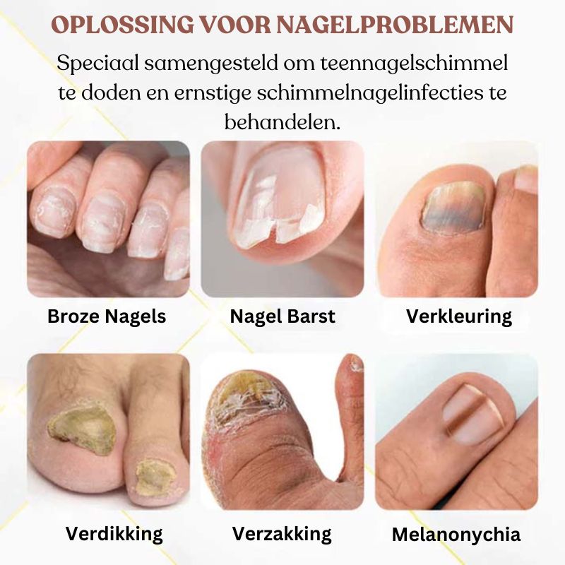 NailRescuePro™ Nagel Herstel Serum