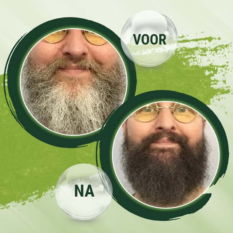 HairRevive™ Resultaat in 2 dagen!