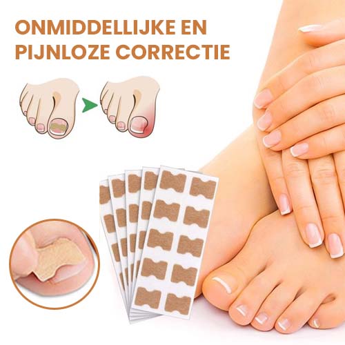 EasyPlaster™ | Corrigerende pleisters voor mooie en gezonde nagels | 25 + 25 Gratis