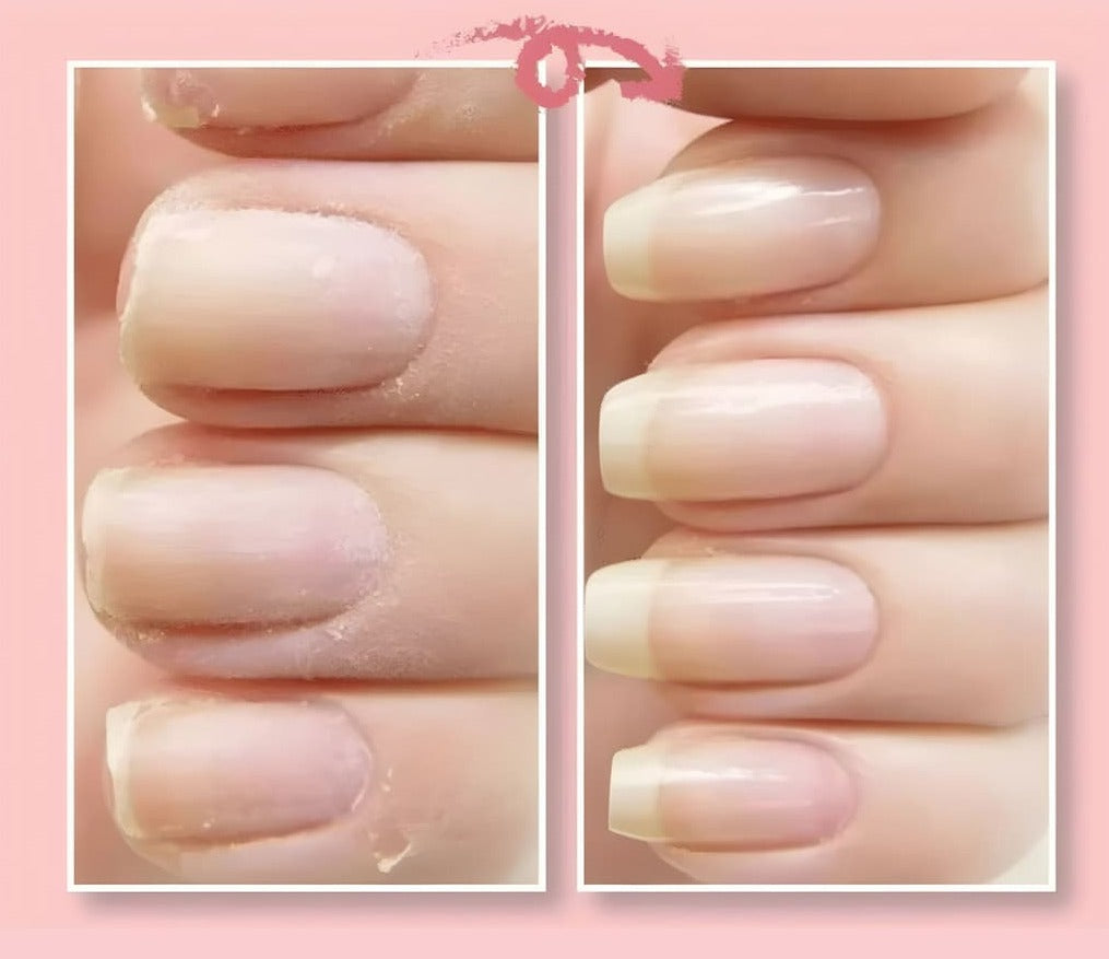 NailRevive™ Nagelreparatie Gel