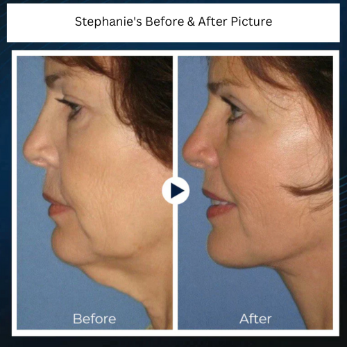 NeckSculpt Pro™ - Verander het uiterlijk van je nek