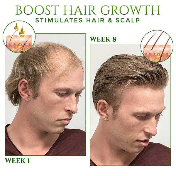 HairSpecialist™ | Groei weer een volle bos haar
