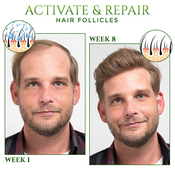 HairSpecialist™ | Groei weer een volle bos haar