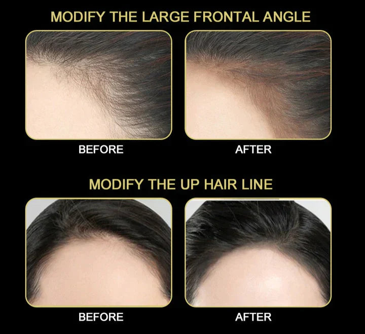 HairlineHaven™ Poeder