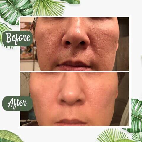 Glowbeauty™ Groene Thee Masker
