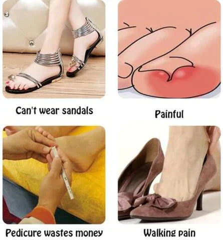 MiraclePatches™ | Krijg mooie en gezonde nagels