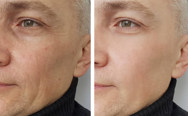 SilkyDerol™ | Drehen Sie die Uhr der Alterung in Sekunden zurück! | 1+1 Gratis