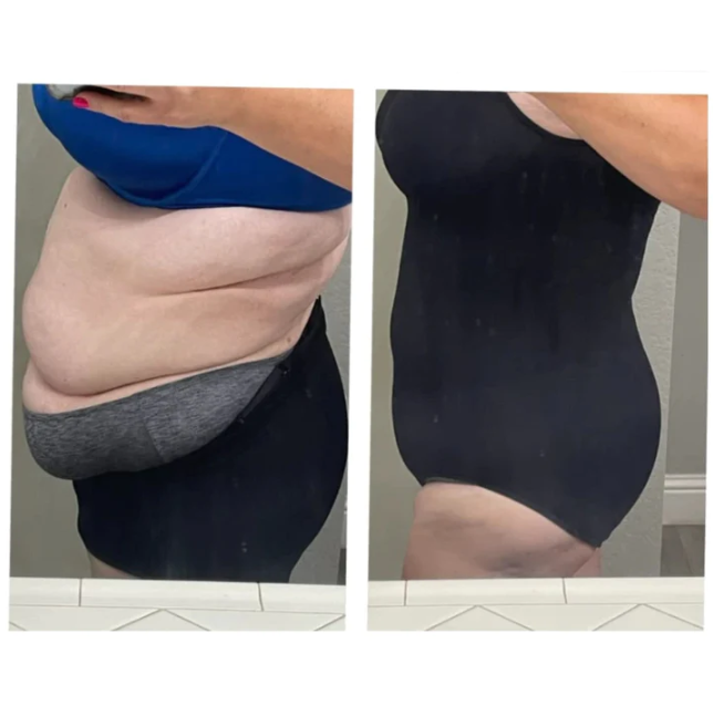 Snatched Bodysuit - KOOP 1 KRIJG 1 GRATIS