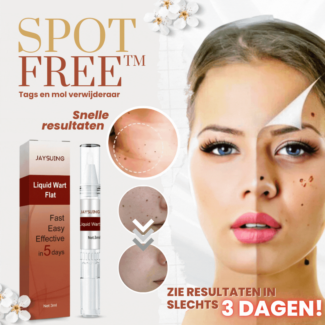 SpotFree™ Tags en moedervlekkenverwijderaar