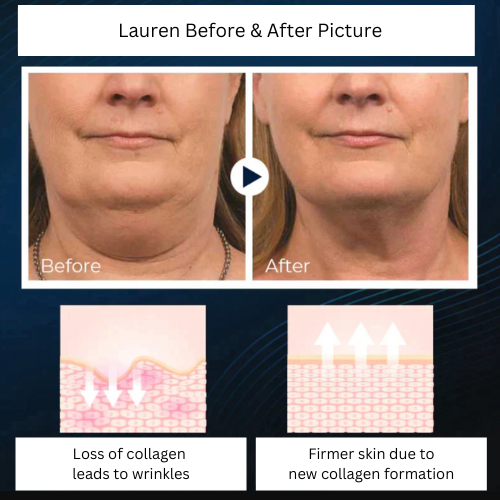 NeckSculpt Pro™ - Verander het uiterlijk van je nek