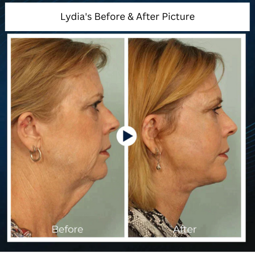 NeckSculpt Pro™ - Verander het uiterlijk van je nek