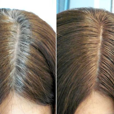 ReGrow™ | Herleef je haar