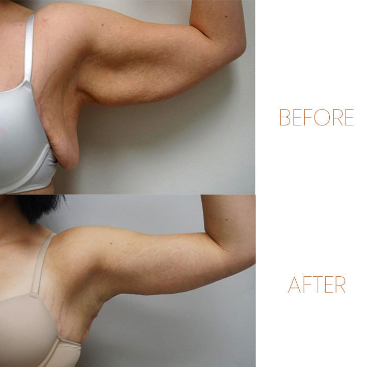 MagneticGo™ Ring Word gezonder en slanker! 1+1 gratis