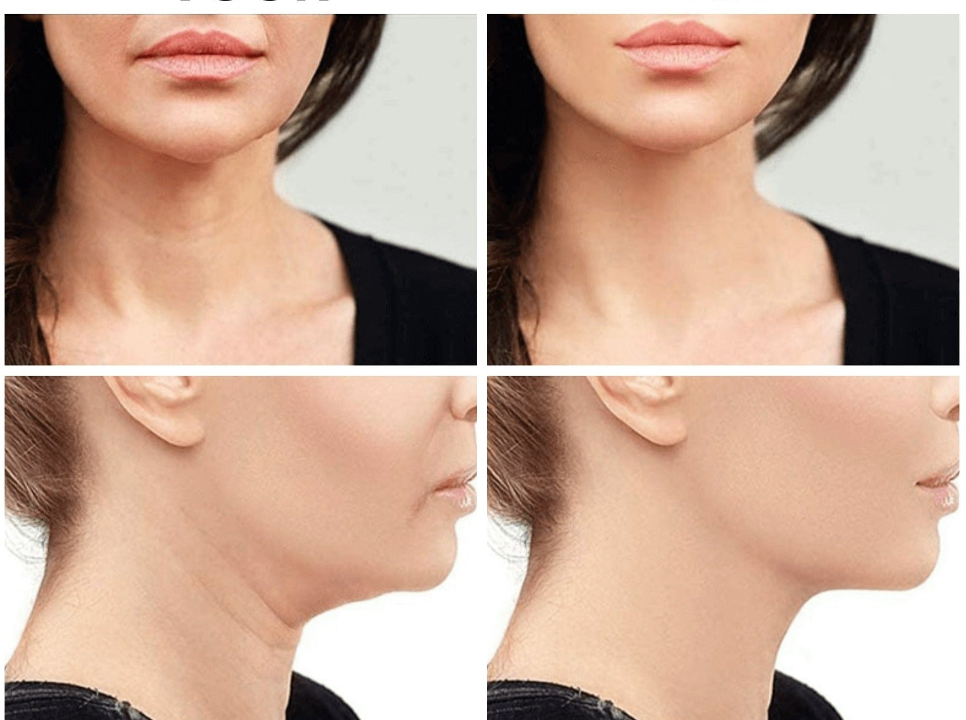 GlowRevive™ LED Gezichtsmassager