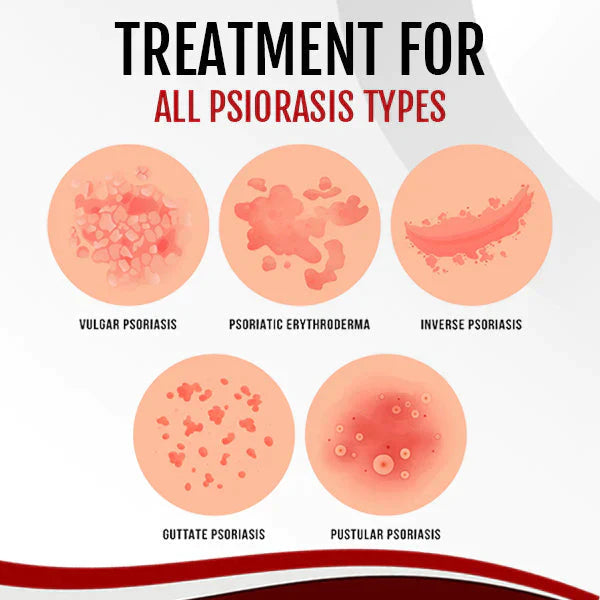 DermaTec | Psoriasis Behandel Spray | 1+1 GRATIS