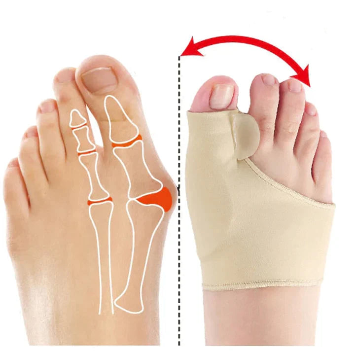 OrthoCertified Hallux valgus corrector