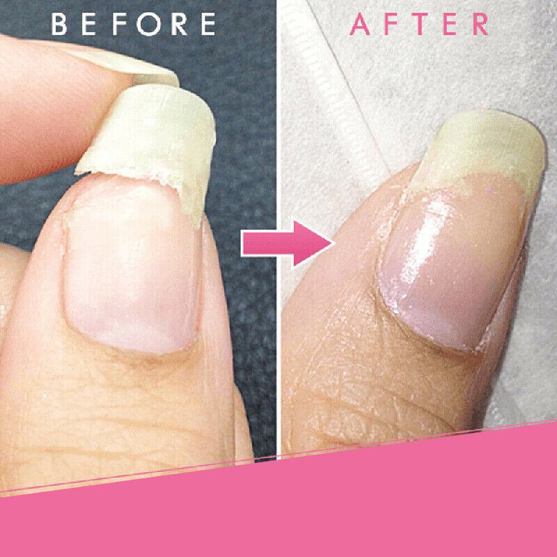 NailRevive™ Nagelreparatie Gel